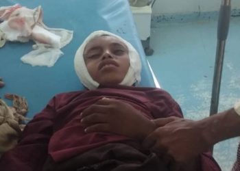 قناص حوثي يصيب طفل امام منزله في حيس بالحديده