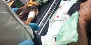 لغم حوثي بلحج يؤدي الي سقوط 13 طفلاً بين شهيد وجريح